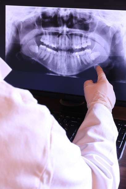Best Emergency Dental Care for Broken or Chipped Teeth in Halfway House, PA