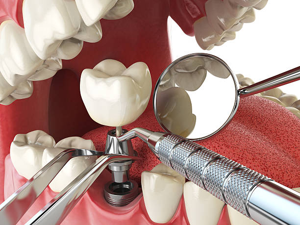 Best Weekend Emergency Dentist in Halfway House, PA